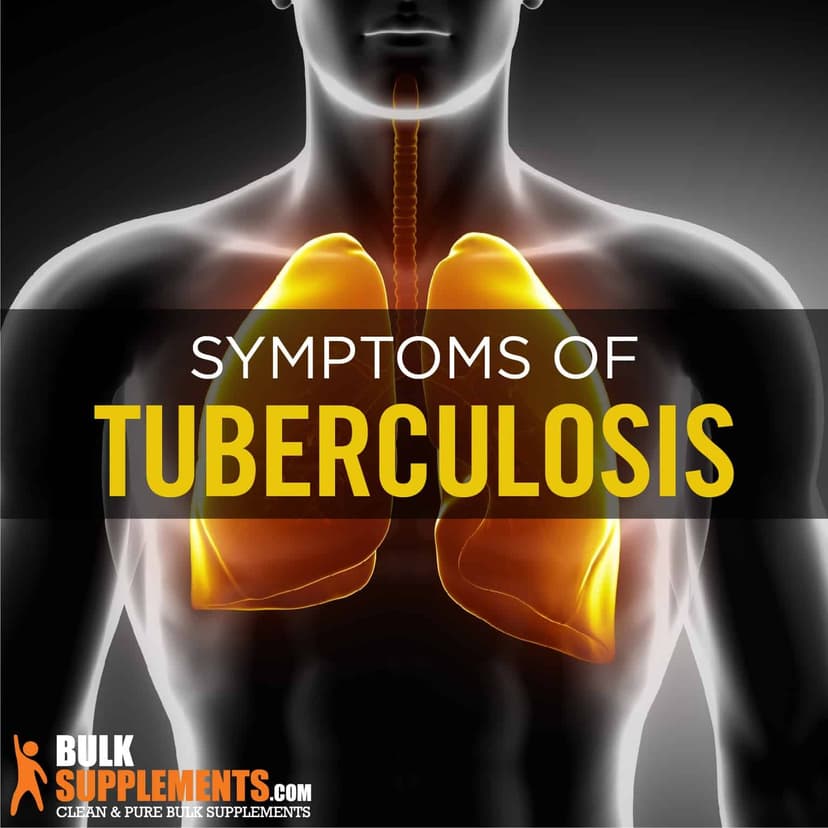 Tuberculosis