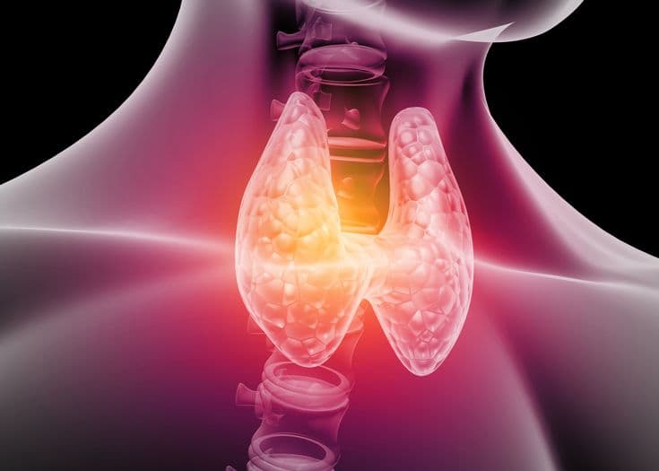 Hypothyroidism